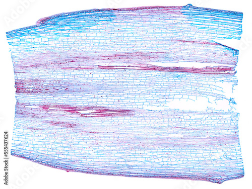 Sunflower stem, longitudinal section, 20X light micrograph. Stem of Helianthus annuus, L.S., under the light microscope. Stained for better visualization. Isolated, on white background. Photo.