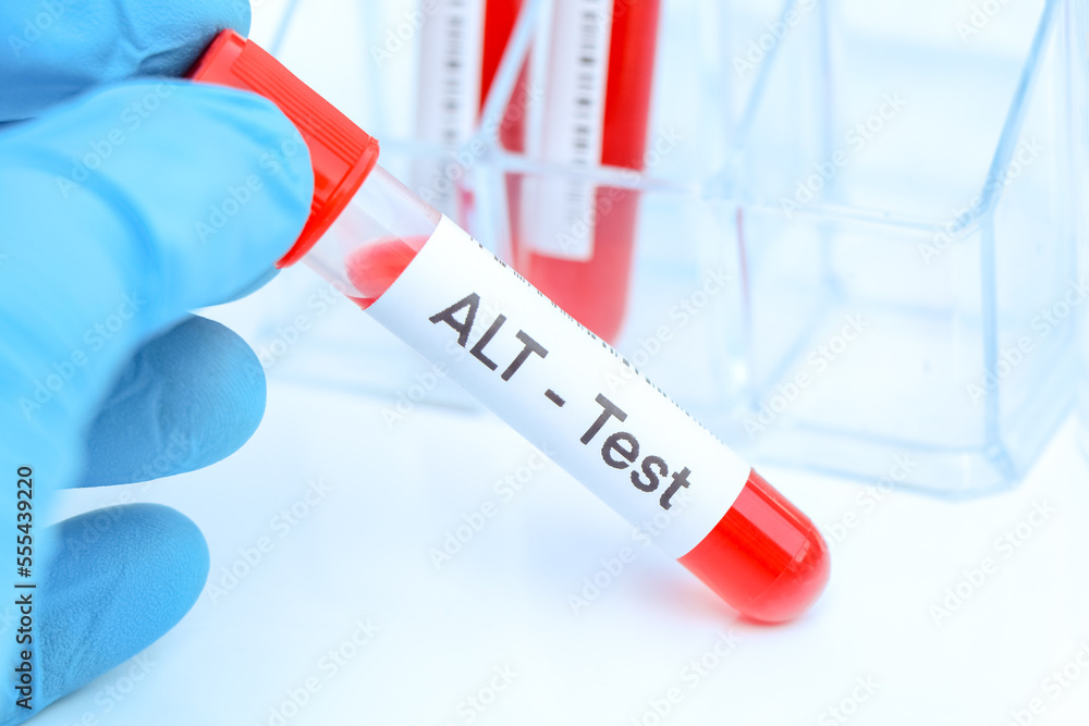 ALT test to look for abnormalities from blood