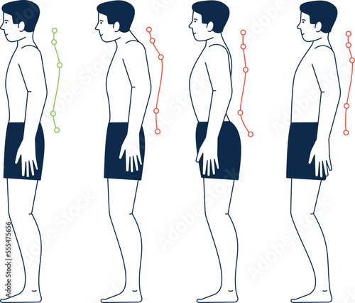 Male body with right and wrong spine postures. Body positions