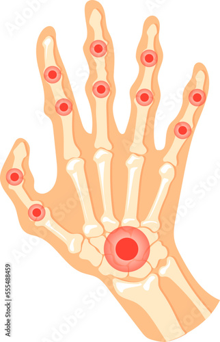 Hand joint pain. Human palm ache red spot