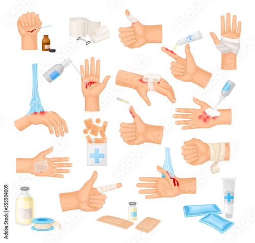 Hands with Injured Skin and Procedures of Bandaging and Wound Cleaning Big Vector Set