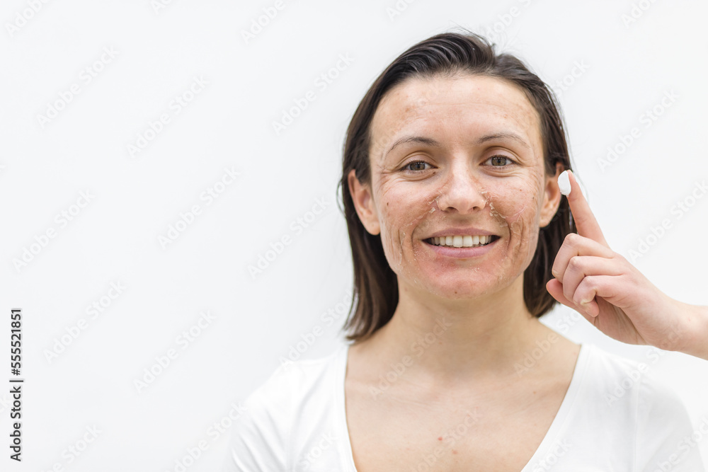 Photo of smiling woman with dry skin and a finger in a cream. Photo of smiling woman with dry skin and a finger in a cream.