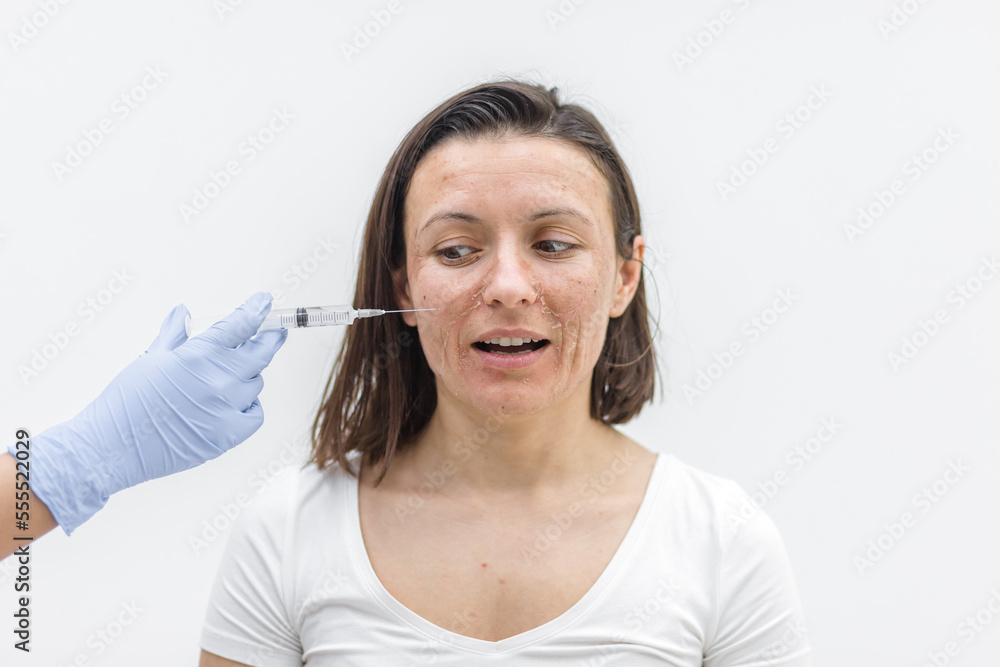 Naklejka premium Close up photo of woman with dry skin and hand in medical glove with injection.