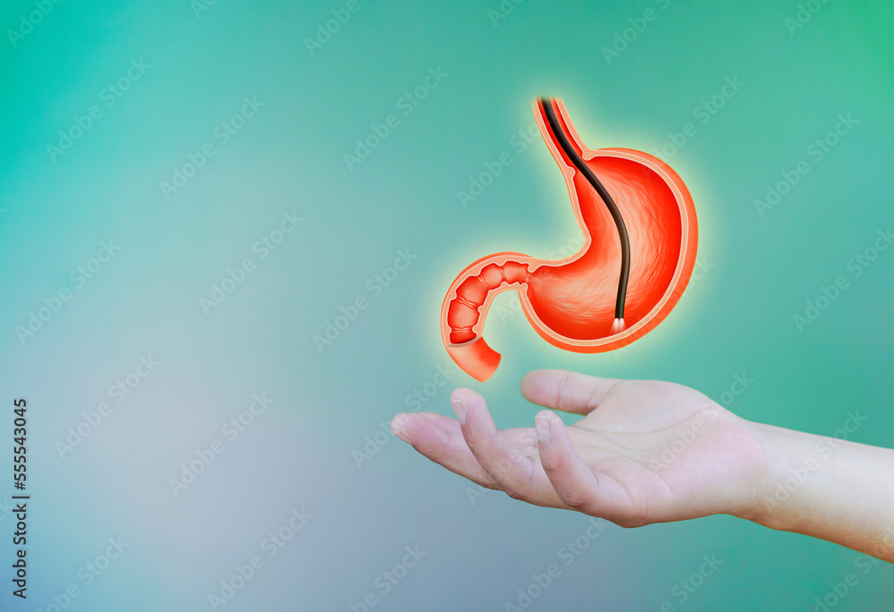 Endoscopic biopsy, esophagogastroduodenoscopy, EGD. Hand holds human