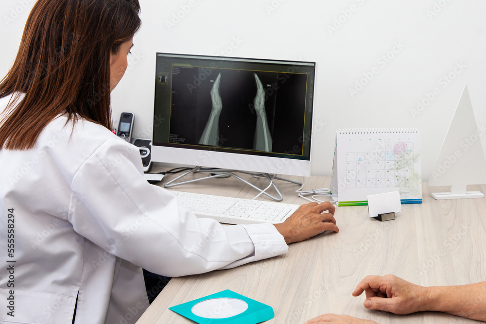 Φωτογραφία Traumatologist female doctor reviewing an x-ray of a patient's hands