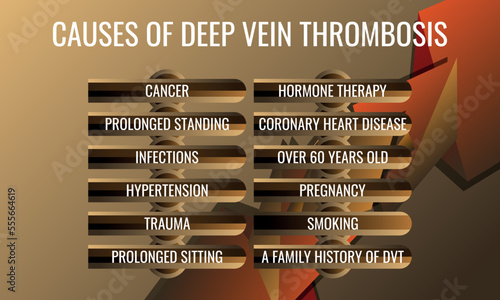causes of Deep vein thrombosis. Vector illustration for medical journal or brochure.