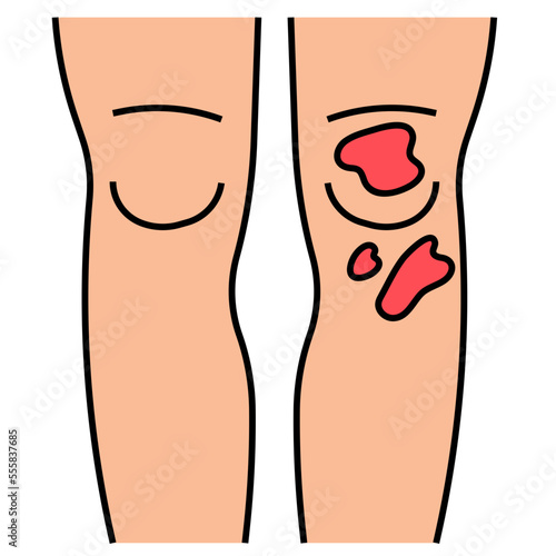 bruise filled outline icon