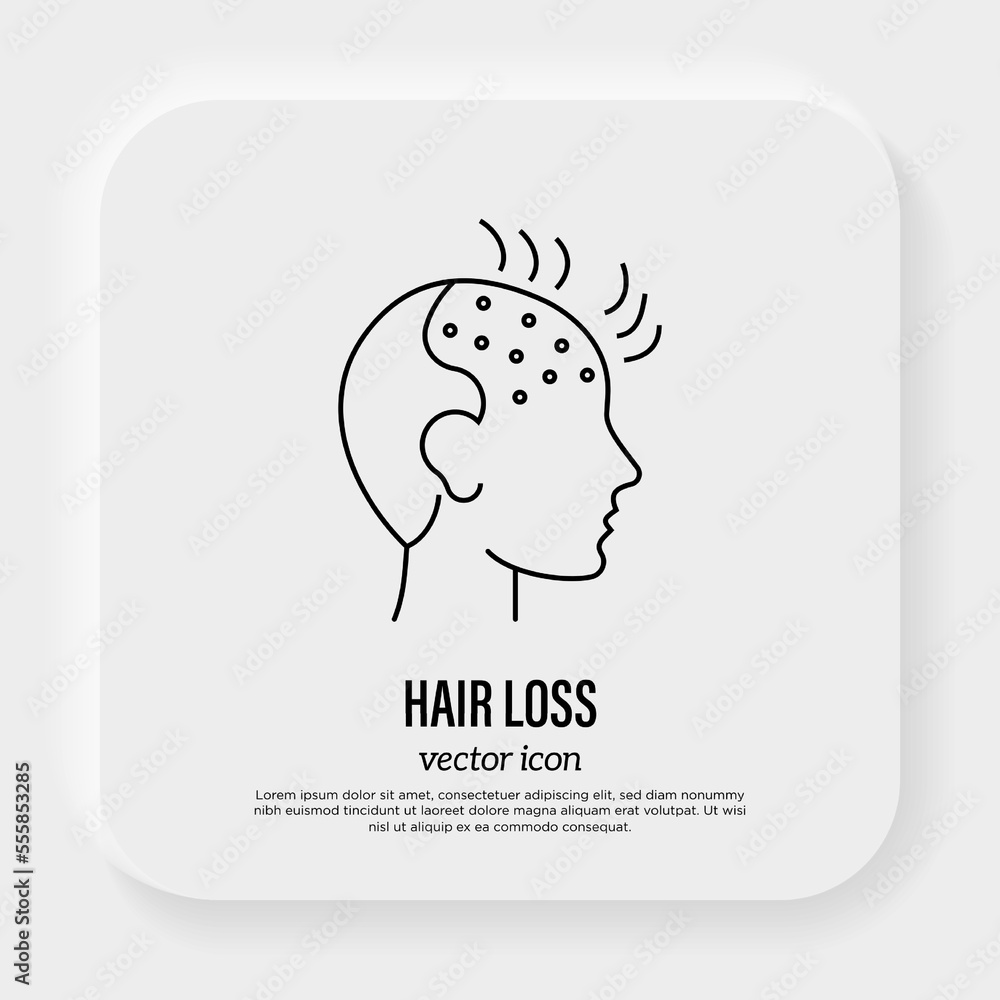 Hair loss. Bald place on men scalp. Alopecia thin line icon. Vector illustration. Hair loss. Bald place on men scalp. Alopecia thin line icon. Vector illustration.