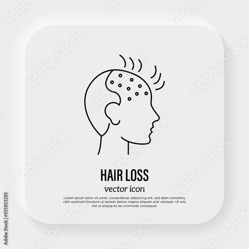 Hair loss. Bald place on men scalp. Alopecia thin line icon. Vector illustration.
