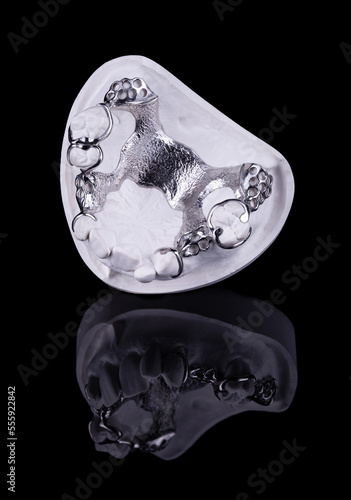 Metal frame of a partial prosthesis on a plaster model
