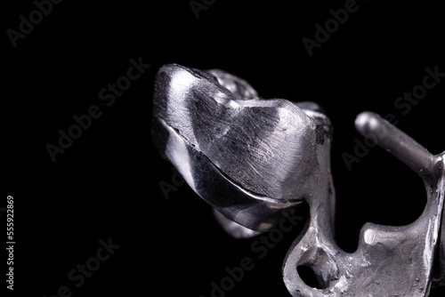 Interlocking metal parts of a crown and a denture