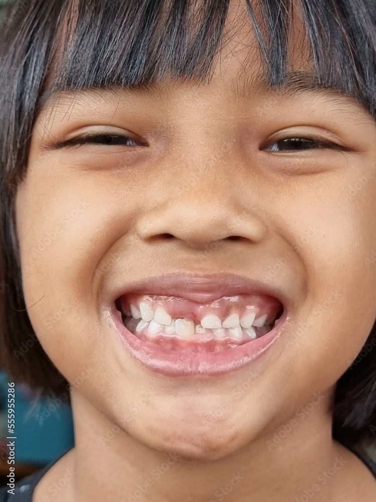 Toothless Asian girl smiling happily Toothless Asian girl smiling happily