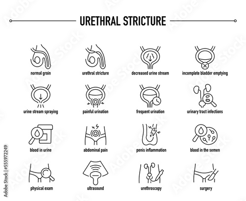Urethral Stricture symptoms, diagnostic and treatment vector icon set. Line editable medical icons. photo