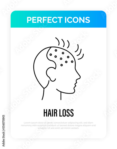 Hair loss. Bald place on men scalp. Alopecia thin line icon. Vector illustration.