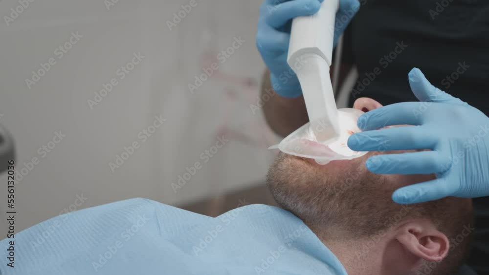 Orthodontist using 3D intraoral scanner for scanning teeth patient's. The dentist holds in his hand a manual 3D scanner for the jaw and mouth. Dental health. Creates a 3D model of teeth Close up Orthodontist using 3D intraoral scanner for scanning teeth patient's. The dentist holds in his hand a manual 3D scanner for the jaw and mouth. Dental health. Creates a 3D model of teeth Close up