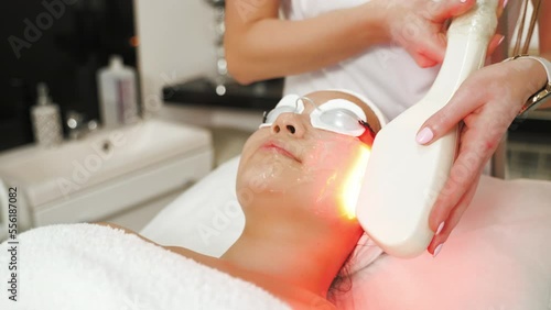 young Asian woman with protective glasses having thermolifting procedure at the beauty center, anti-aging treatment concept. High quality 4k footage photo