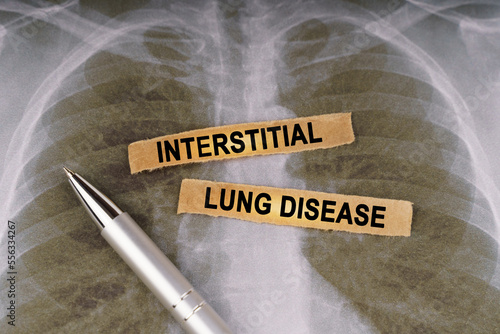 On a human chest x-ray, a pen and strips of paper labeled - INTERSTITIAL LUNG DISEASE photo