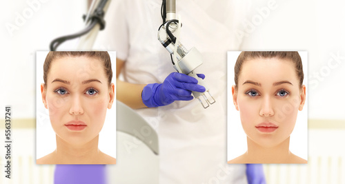 Laser Treatment,Cosmetic Laser Dermatology ,Ageing skin photo