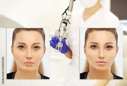 Laser Treatment,Cosmetic Laser Dermatology ,Ageing skin photo