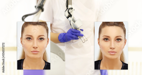 Laser Treatment,Cosmetic Laser Dermatology ,Ageing skin photo