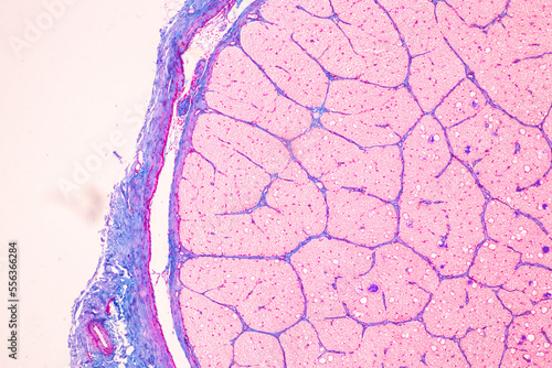 Characteristics Tissue of Optic nerve Human, Cornea from eye Human and Eyelid Human under the microscope in Lab. photo