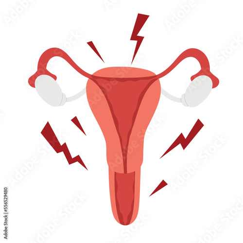 Emergency acute pain. Strong PMS pain during periods. Flat vector illustration