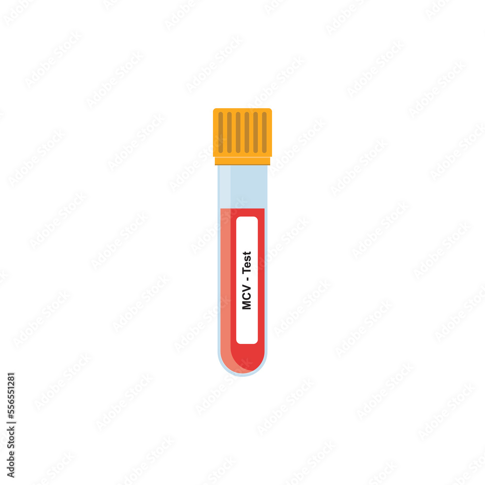 MCV Blood Test Concept Design. Vector Illustration. MCV Blood Test Concept Design. Vector Illustration.