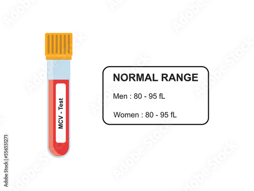 MCV Blood Test Concept Design. Vector Illustration.