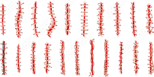 Suture icons set cartoon vector. Wound surgical. Doctor laceration