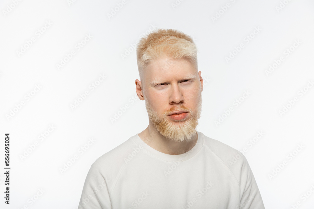 bearded and serious albino man in t-shirt looking at camera isolated on white bearded and serious albino man in t-shirt looking at camera isolated on white