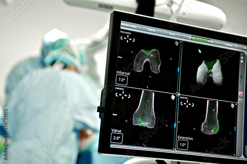 Surgeons in an operating room with diagnostic images on a screen in the foreground photo