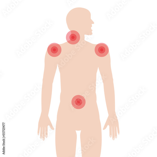 A silhouette of a man with a schematic image of pain in the shoulder joints, neck and lower back. Vector illustration