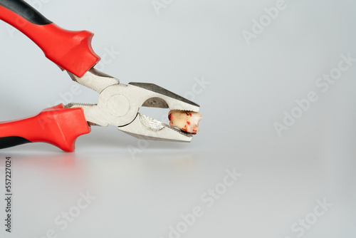 Tooth extraction with dental tools with caries by a professional stamatologist in a dental office. Pliers holding a wisdom tooth. Dentistry concept. photo