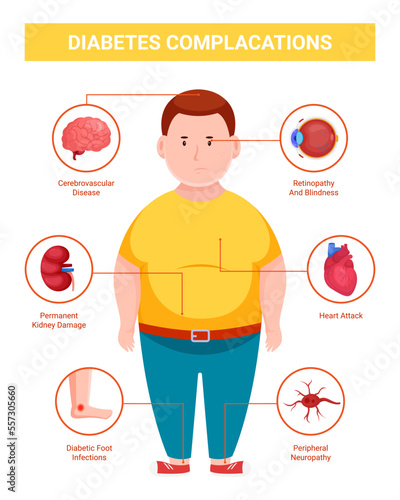 Diabetes complications infographic, illustration of a man with diabetes photo