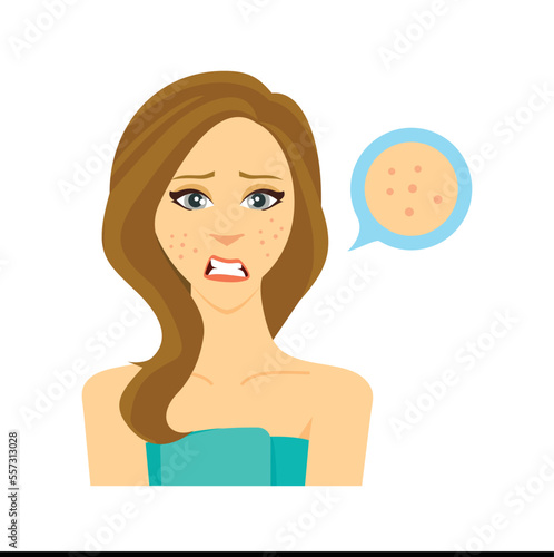 Unhappy Girl With Pimples On Her Face