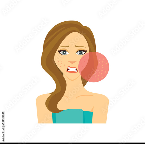 Unhappy Girl With Pimples On Her Face