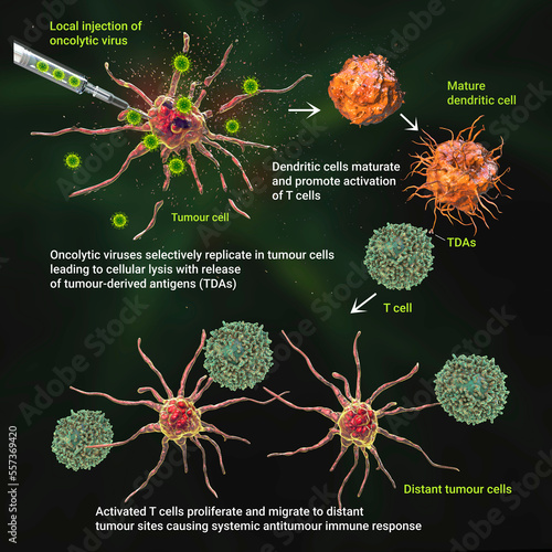 Oncolytic viral therapy, illustration photo