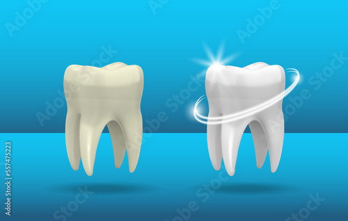 Realistic tooth. 3d teeth whitening. Realistic Healthy tooth with glowing effect.