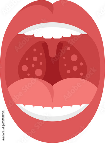 Mouth tonsillitis icon flat vector. Tonsil anatomy. Bacterial ent isolated