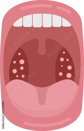 Mouth disease icon flat vector. Bacterial anatomy. Ent inflammation isolated