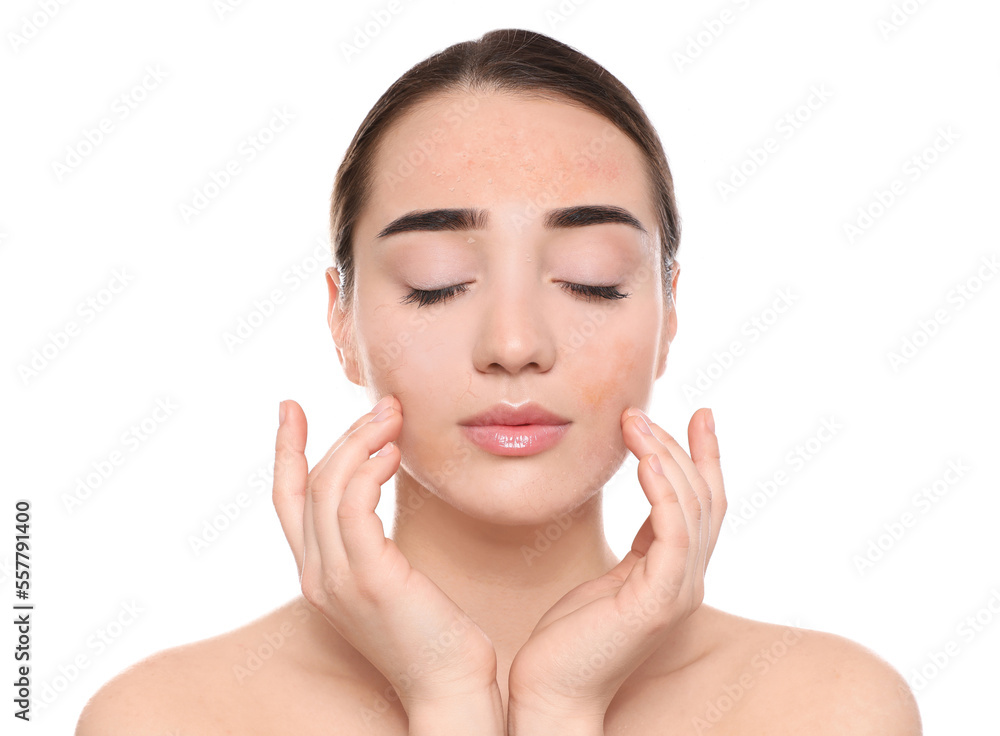 Young woman with dry skin on white background Young woman with dry skin on white background