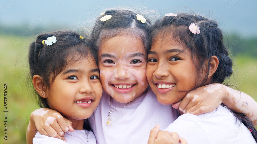 Little cute alpha young albino vitiligo small girl group smile look at camera fun joy hug in meadow field. Melanin face body of asia people gen z kid self love happy diverse of beauty skin care color. Little cute alpha young albino vitiligo small girl group smile look at camera fun joy hug in meadow field. Melanin face body of asia people gen z kid self love happy diverse of beauty skin care color.