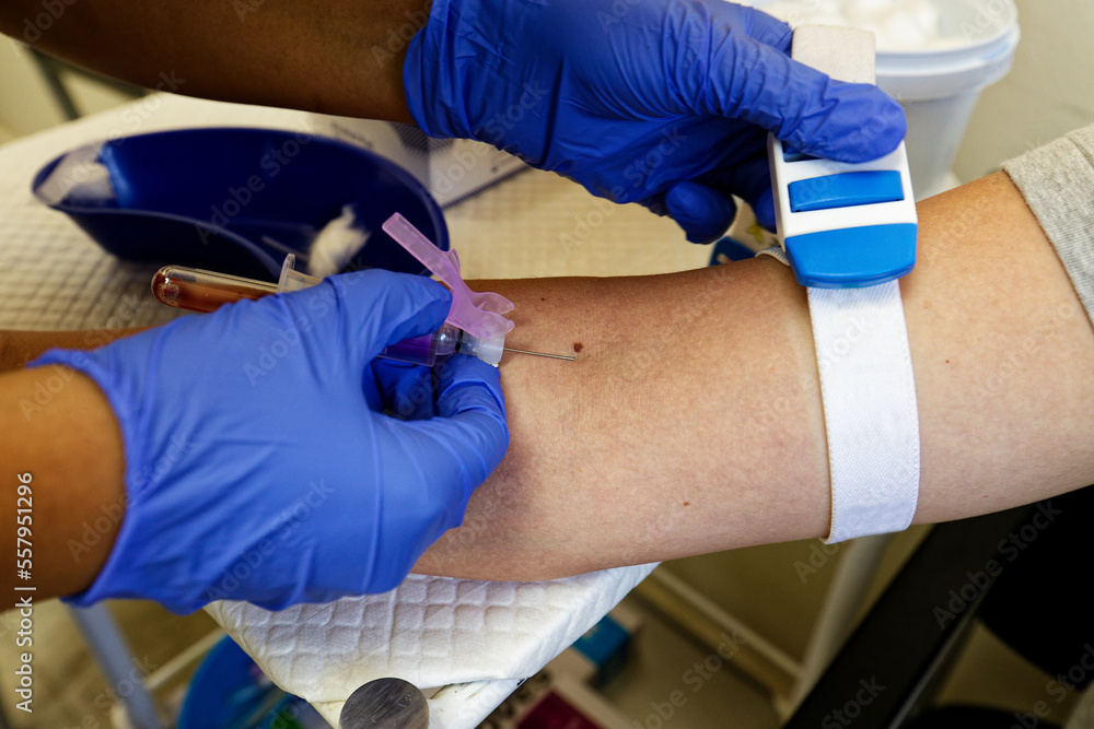 Blood drawn from a young, female patient, showing he arm and the needle
