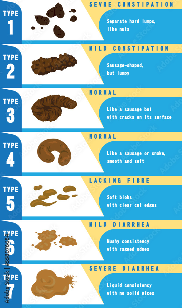Types Of Stools Bristol Stool Size Chart DUZNS Types Of Stools Bristol Stool Size Chart DUZNS