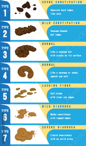 Bristol stool chart with faesces type classification. Vector illustration different type excrement- from constipation to diarrhea health indicator.