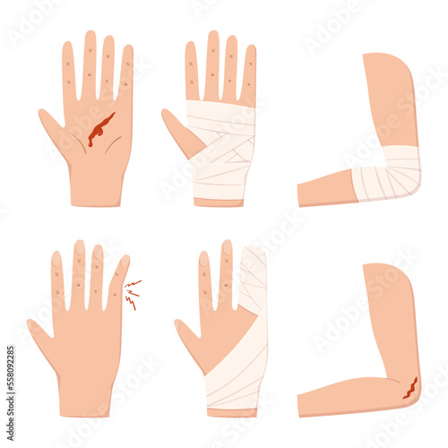 Set of Hand, Palm, Elbow, Finger and Arm Injury with Blood and Bandage Isolated on White Background. First Aid, Health