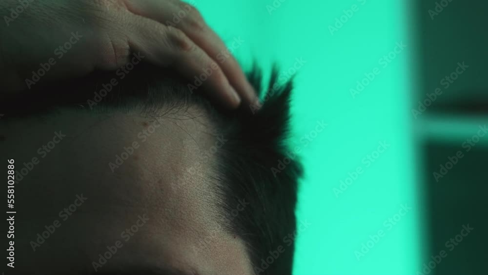 Man with bald spots suffering from hair loss. Treatment of hair problem. Male examines his bald spots in the mirror. Man with bald spots suffering from hair loss. Treatment of hair problem. Male examines his bald spots in the mirror.