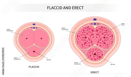 neurogenic hormones disorder of the Peyronie's disease Erectile dysfunction and mental depression erect traumatic cardiovascular level drug photo