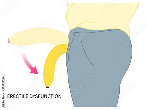 Erectile dysfunction disease and mental depression disorder hormones of the Peyronie's erect traumatic cardiovascular level drug neurogenic