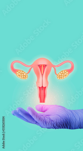 hand holding a T-shaped birth control intrauterine device, IUD inside the female reproductive organ. Copper IUD. modern medicine science